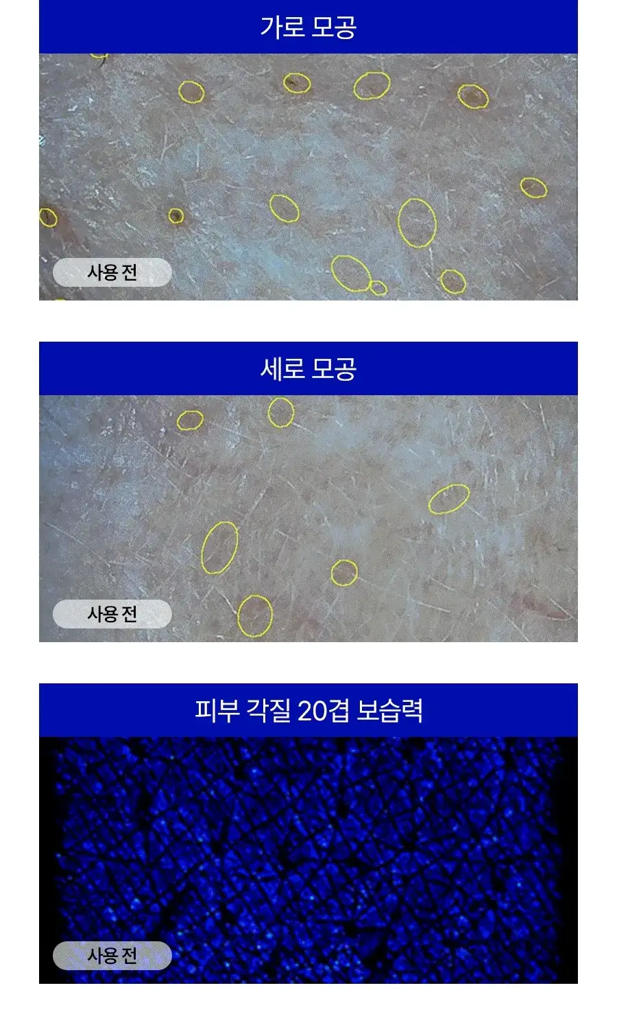 [모공플럼핑 수분앰플] 메디필 히알루론산 레이어 물톡스 앰플 30ml 상세페이지 12